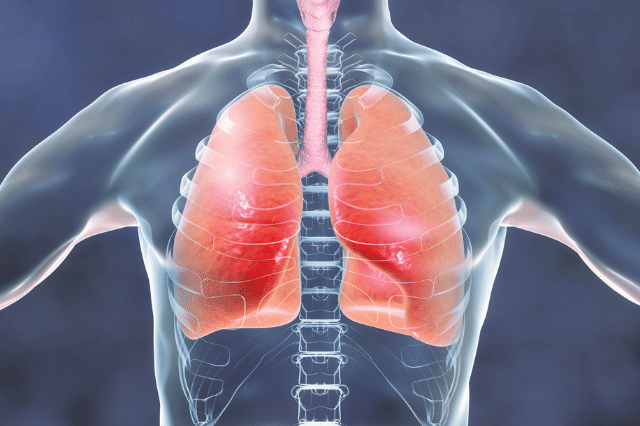 団体信用生命保険 肺・気管支系の病気